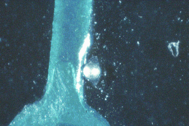 Figure 4: Solder on a resist can wet during wave contact and leave a ball Figure 4: Solder on a resist can wet during wave contact and leave a ball